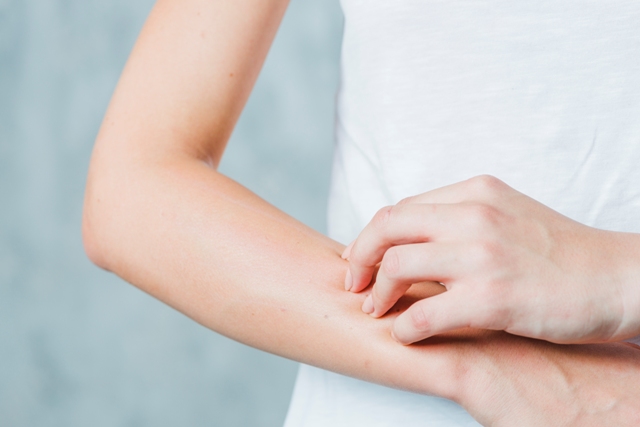 We Answer 12 Questions About Bed Bug Bites