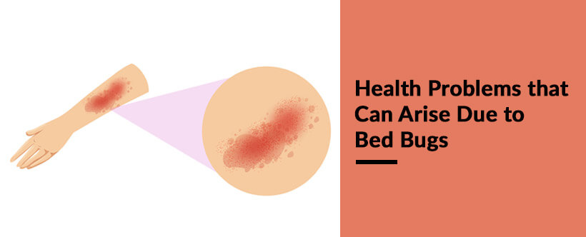 6 Health Problems that Can Arise Due to Bed Bugs